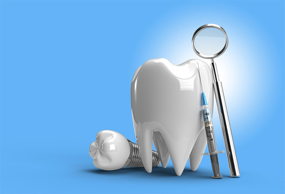 Dental-Implants-img