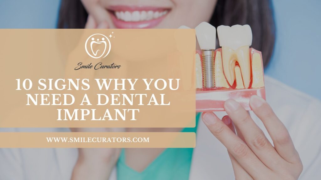 10 Signs You May Need a Dental Implant Instead of Saving a Tooth