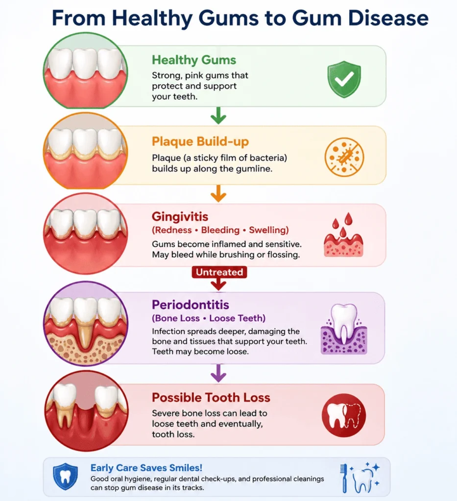 From Healthy Gums to Gum Disease