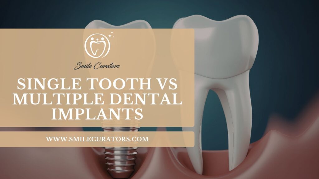 Multiple-Dental-Implants-Which-Treatment