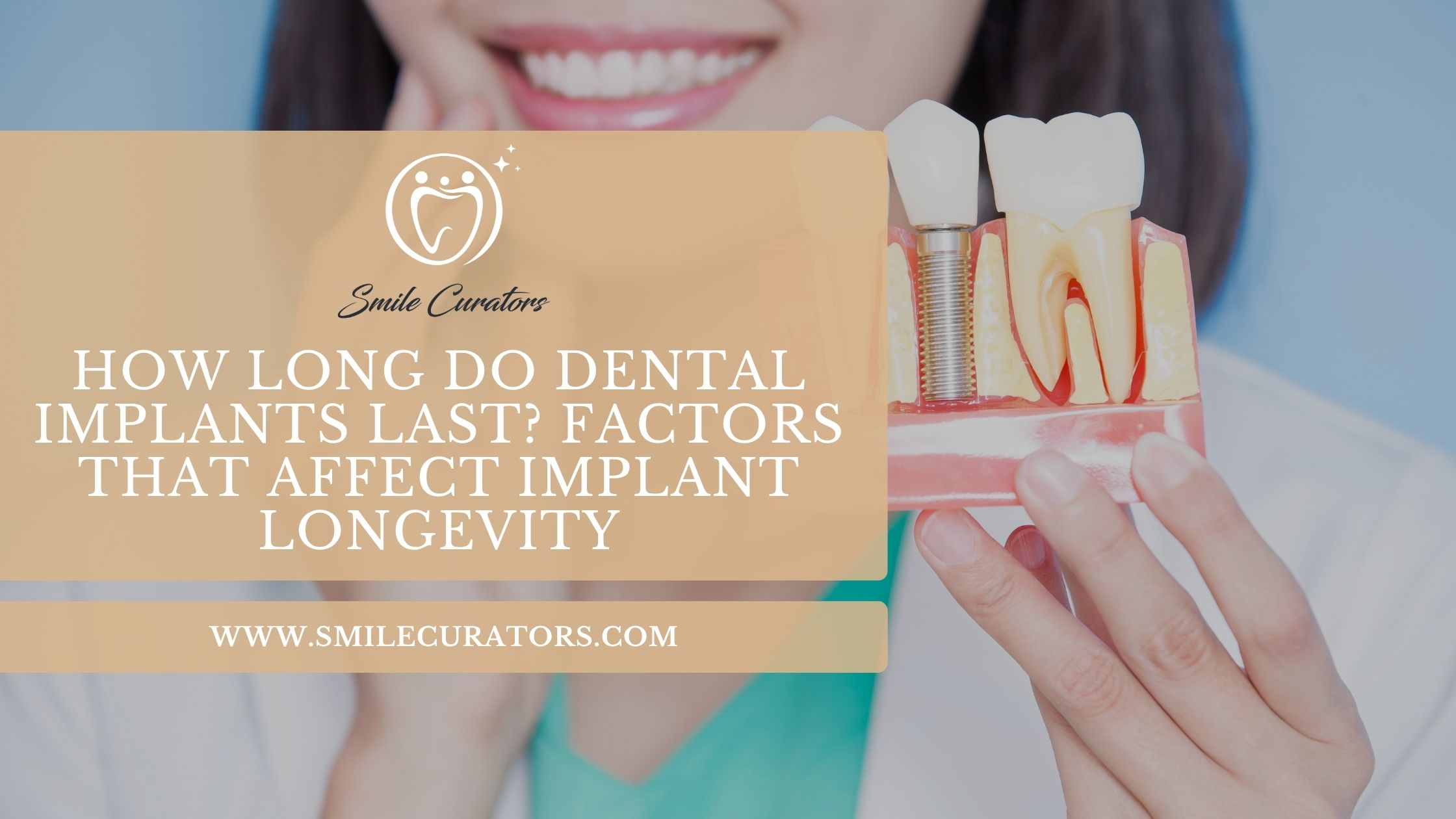 Dental implant model showing an implant post supporting a replacement tooth
