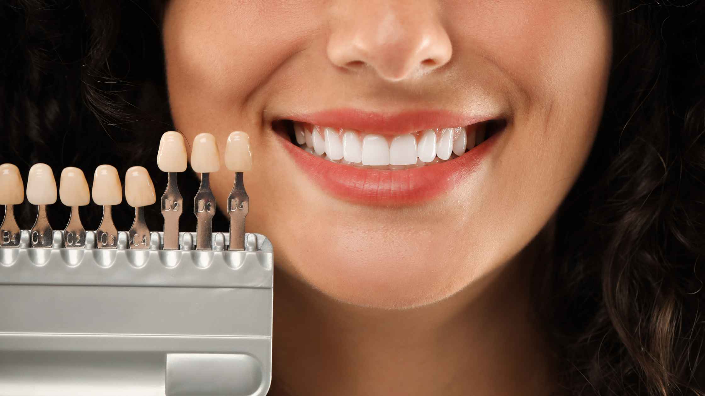 Dental veneers and tooth shade guide for smile enhancement
