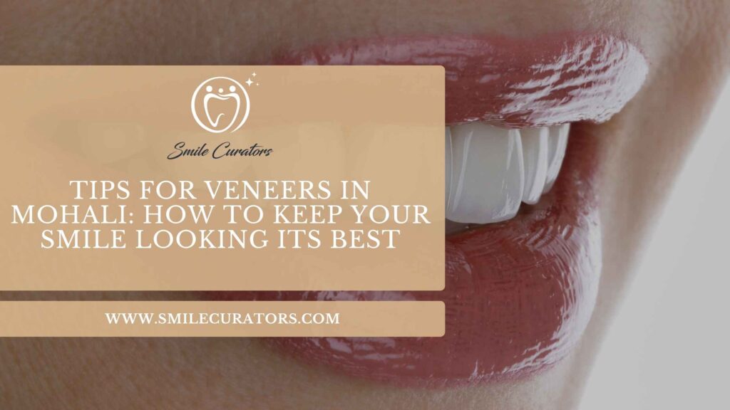 Tips for veneers in Mohali and maintaining a healthy smile