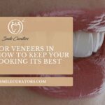 Tips for Veneers in Mohali: How to Keep Your Smile Looking Its Best