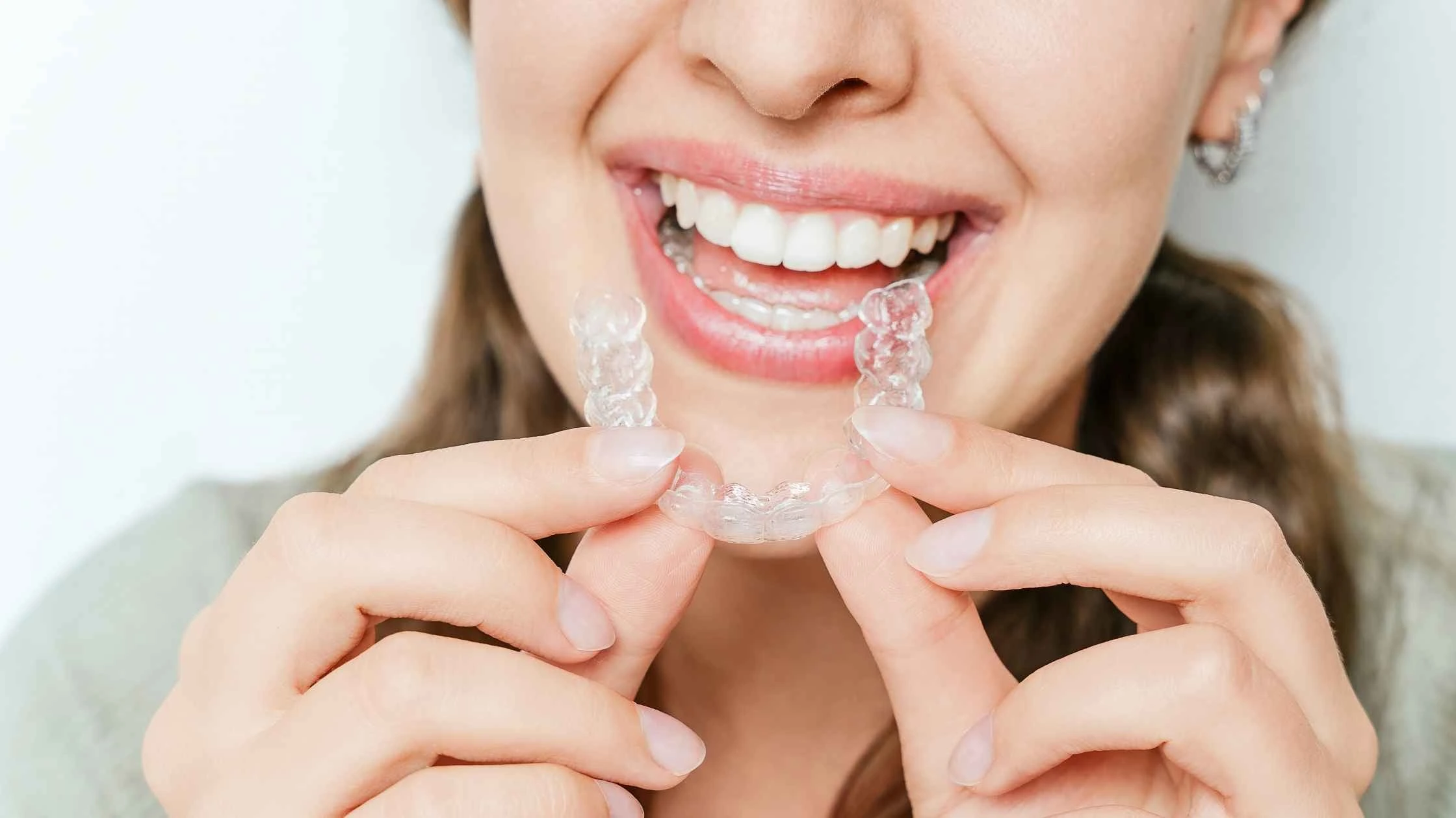 Woman removing clear aligners from her teeth